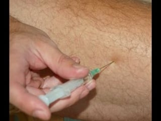 Внутримышечная инъекция в бедро | intramuscular self injection