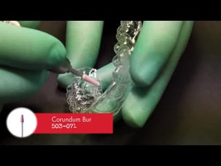 Thermalorth philosophy (top) aligner expansion screw