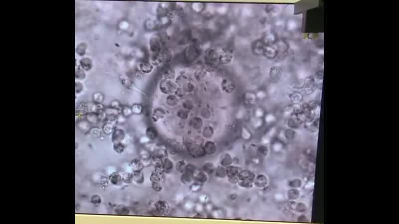 Оплодотворение яйцеклетки