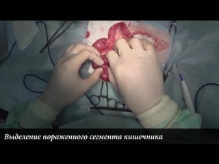 Резекция и анастомоз кишечника у кота (intestinal resection in cat)