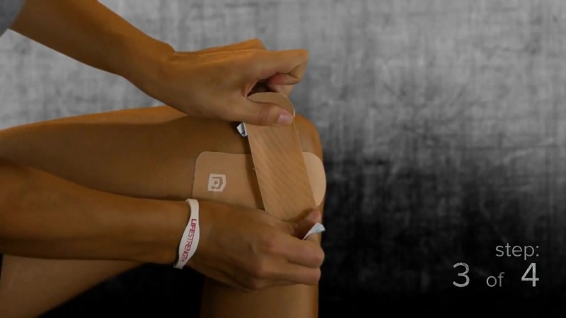 Кинезиотейпирование внутренней части коленного сустава