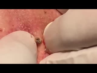 Огромные черные точки на спине