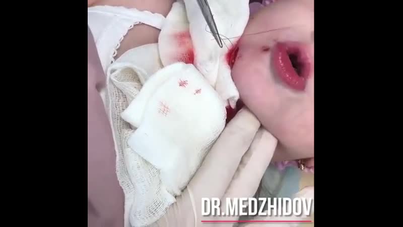 👄 злые стоматологи