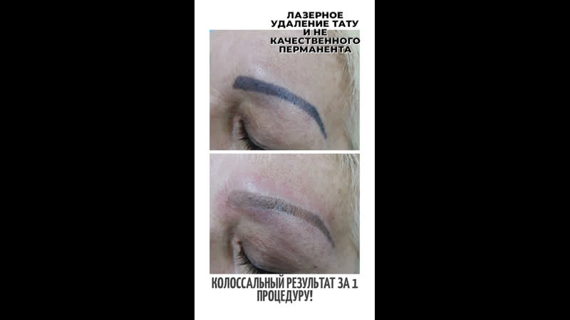 Удаление некачественного перманента
