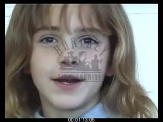 Bts emma watson getting her fake teeth