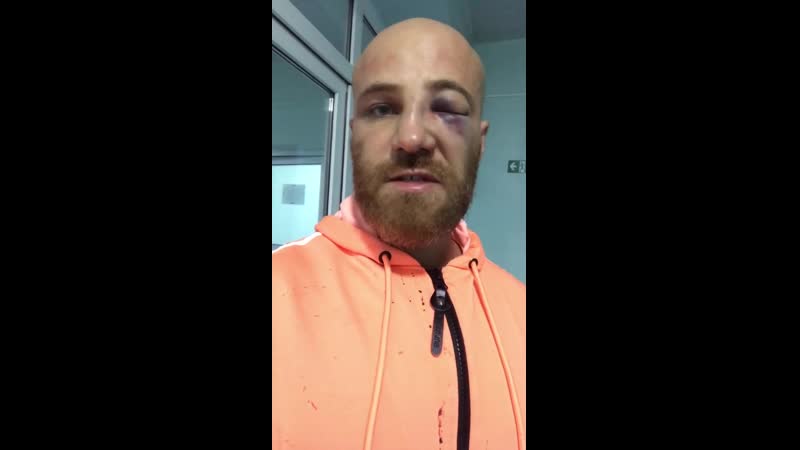 Юрий толочко последствия от митинга