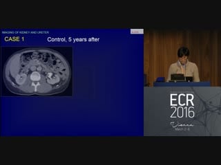 Imaging of kidney and ureter m a cova