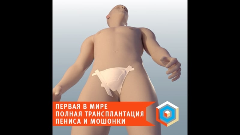 Первая в мире полная трансплантация пениса и мошонки