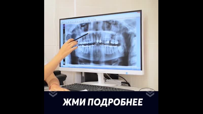Консультация и диагностика + панорамный снимок + план лечения бесплатно!