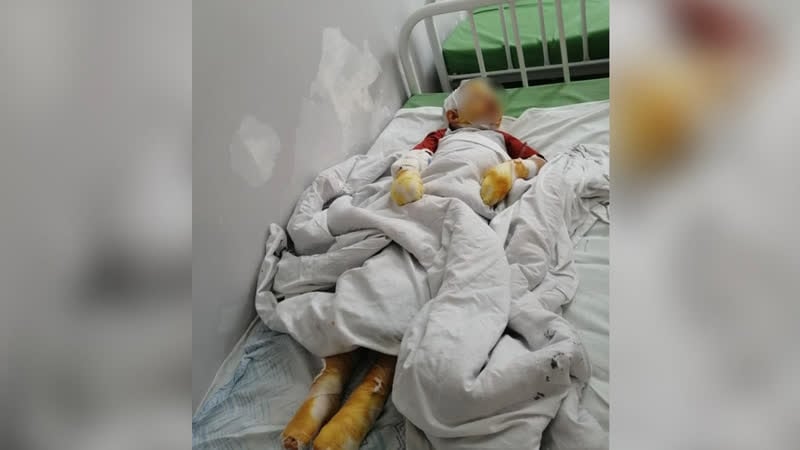 Мужчина решил отомстить жене за развод и попытался сжечь четырёхлетнего сына