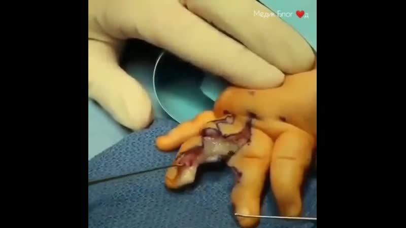 Что за патология на руке этого ребенка?