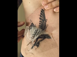 Заживляющая плёнка