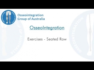 Benefits of osseointegration patient video