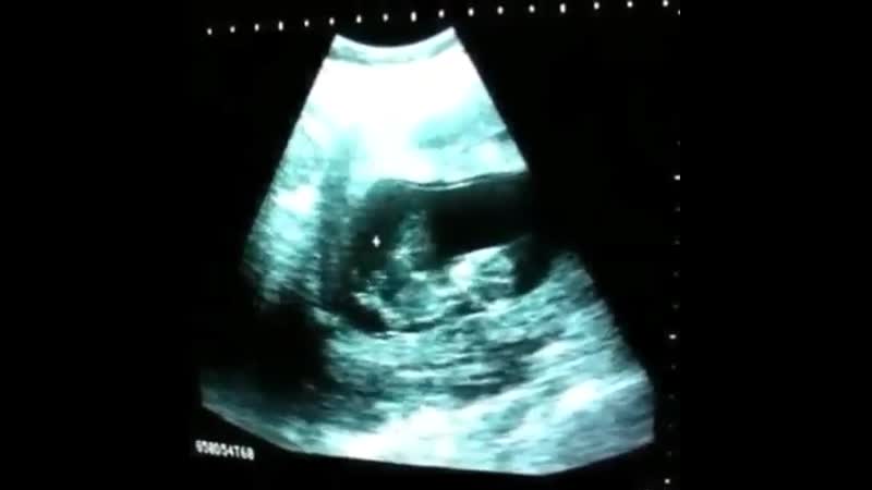 Как развлекается эмбрион?