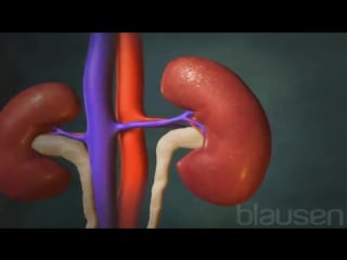 1 камни в почках