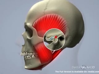 Airway and tmj english