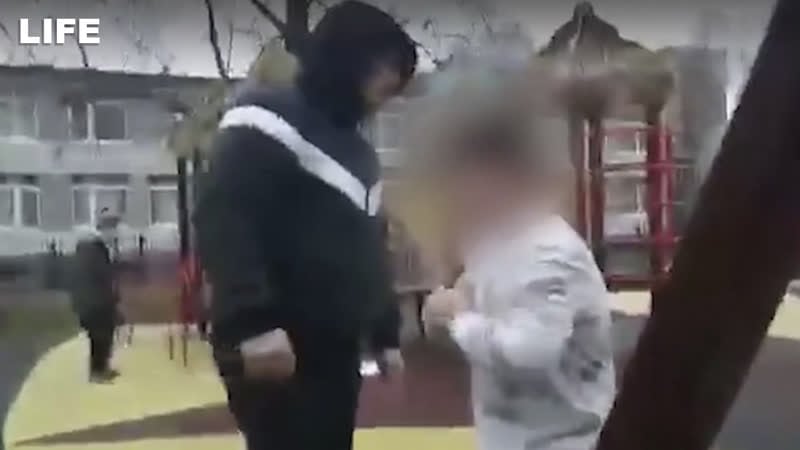 Отец вмешался в драку между молодые и сломал мальчику руку