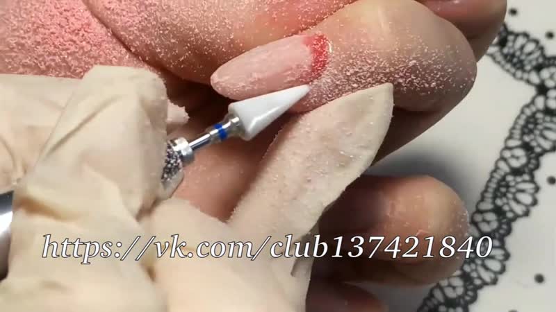 Керамическая фреза конус заменяет привычную "кукурузку" и фрезу палочку