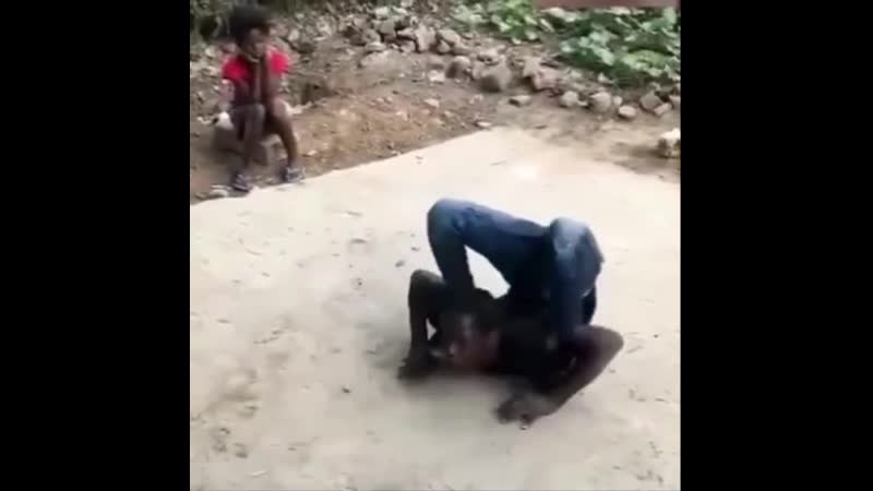 Ноги колесом