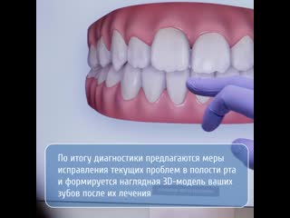 Каппы invisalign (инвизилайн) в gms dental