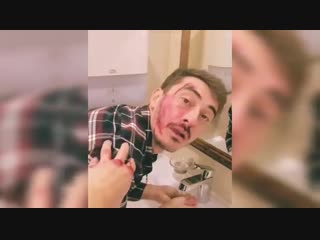 Серго разбил еб@lник