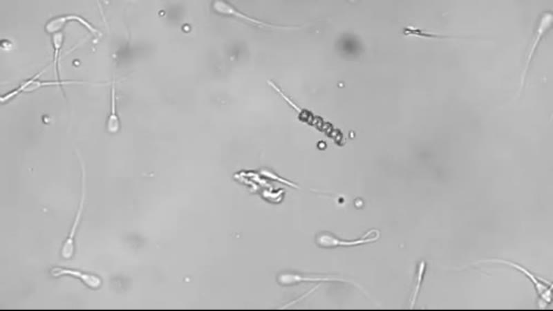 Нанобот оплодотворяет яйцеклетку