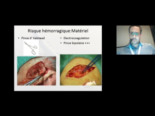 Bien préparer son geste chirurgical