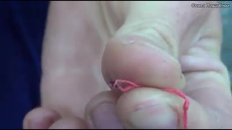 Как вытащить клеща ниткой