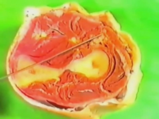 Область предплечья