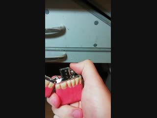 My brother in law makes dental prosthetics and decided to modify this lighter