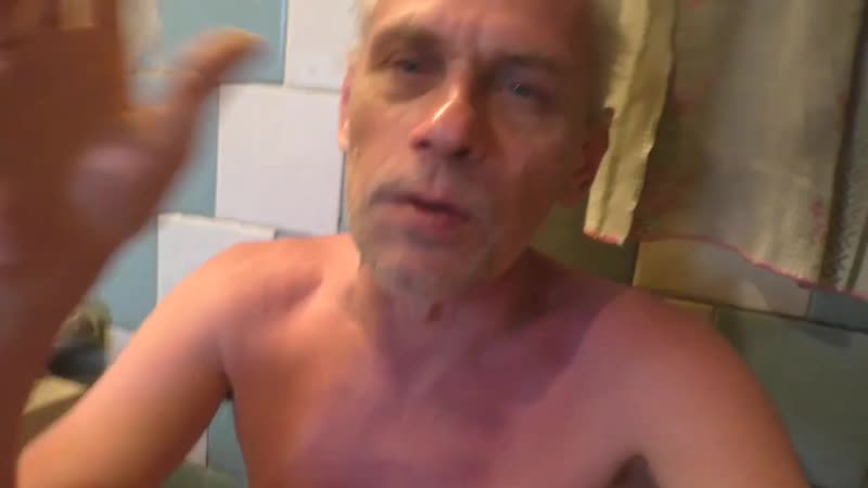 Проголосовал за попраи и поджарил голени на солнце