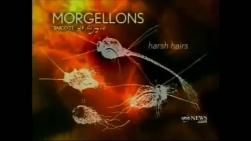 Chemtrails spraying nanofibers and nanobots organisms are in you