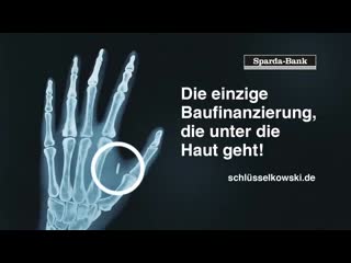 Sparda bank macht werbung für implantierten rfid chip,