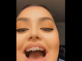 Минет с брекетами