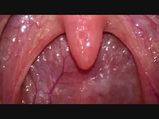 Throat and uvula close up