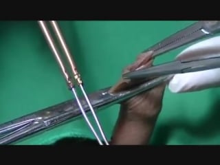 Dr mahdian circumcision technique using eletric cauter