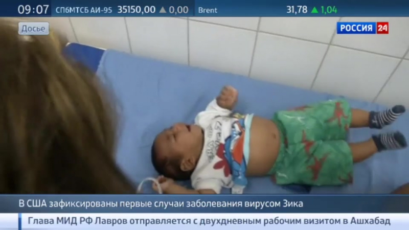 В сша зафиксирован первый случай заражения вирусом зика