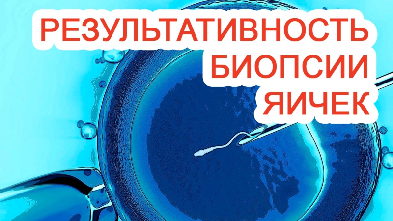Результативность биопсии яичек
