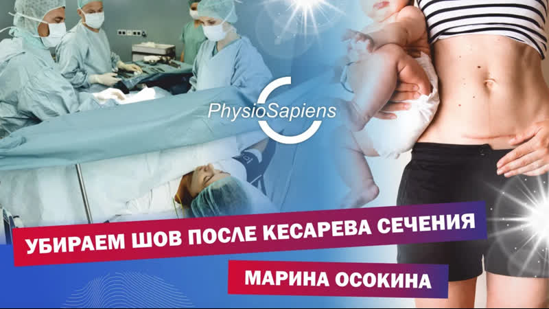 Убираем шов после кесарева сечения