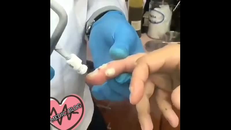 Расскажите что тут? бородаи удаляют?