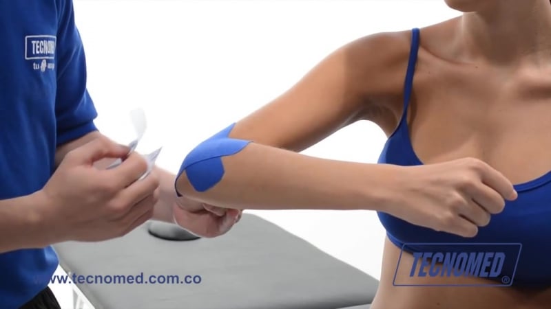 Локоть теннисиста