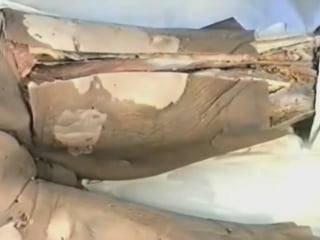 Топографическая анатомия бедра