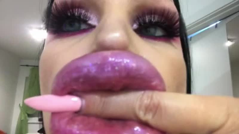 #lipsfiller #lipfiller #biglips #hugelips #siliconelips #пухлыегубы #силиконовыегыбы #большиегубы #филлер #filler #fillers #lips