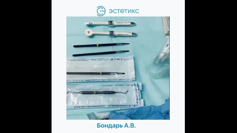 Реставрация 1 1 и 2 1 зубов адгезивный протокол single bond2, estelite asteria a2b, ne бондарь а в