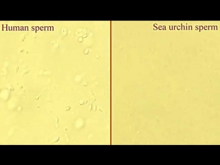 Human vs sea urchin sperm