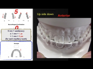 Cast radiograph evaluation (cre) part 3 ортодонтия