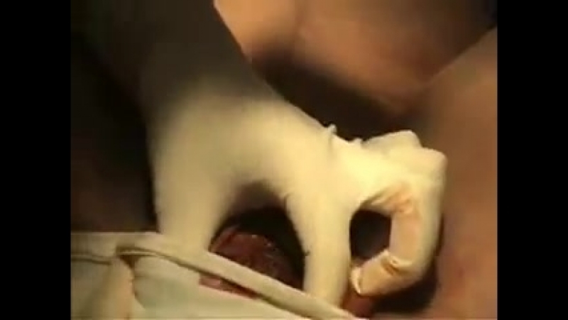 Рождение ребенка birth