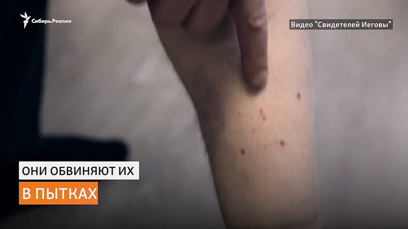 Экспертиза подтвердила пытки "свидетелей иеговы" из сургута | сибирь реалии