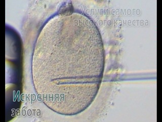 Fertilizare in vitro экстракорпоральное оплодотворение medpark