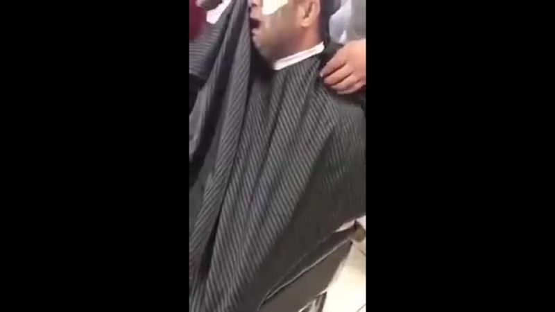 Эпиляция по мужски